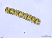 ギムノディニウム